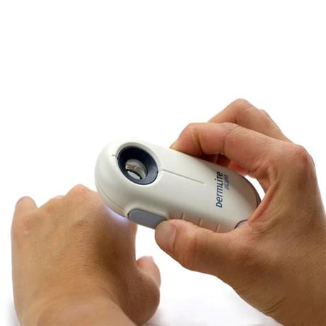 DermLite DL100 dermatoscope for melanoma detection and skin lesion examination.