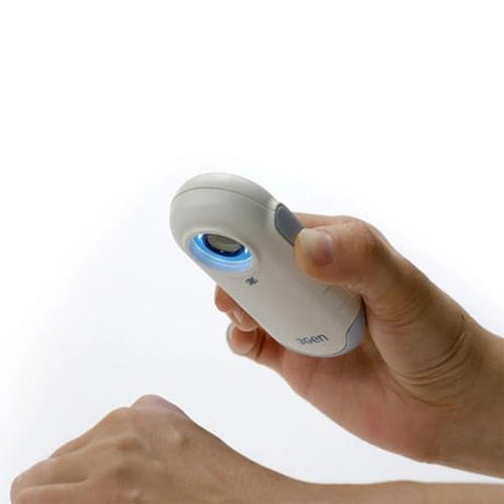 DermLite DL100 dermatoscope for melanoma detection and skin lesion examination.